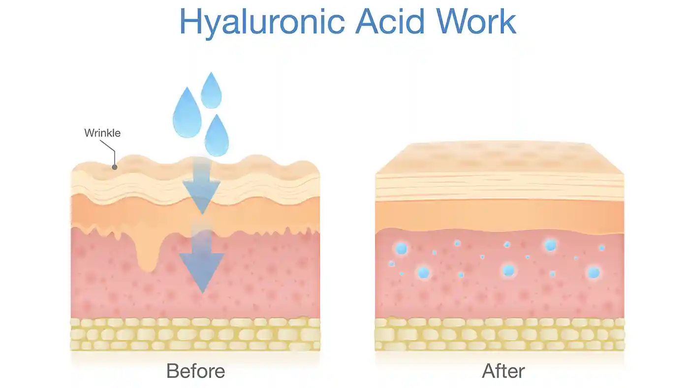 How Hyaluronic Acid works diagram